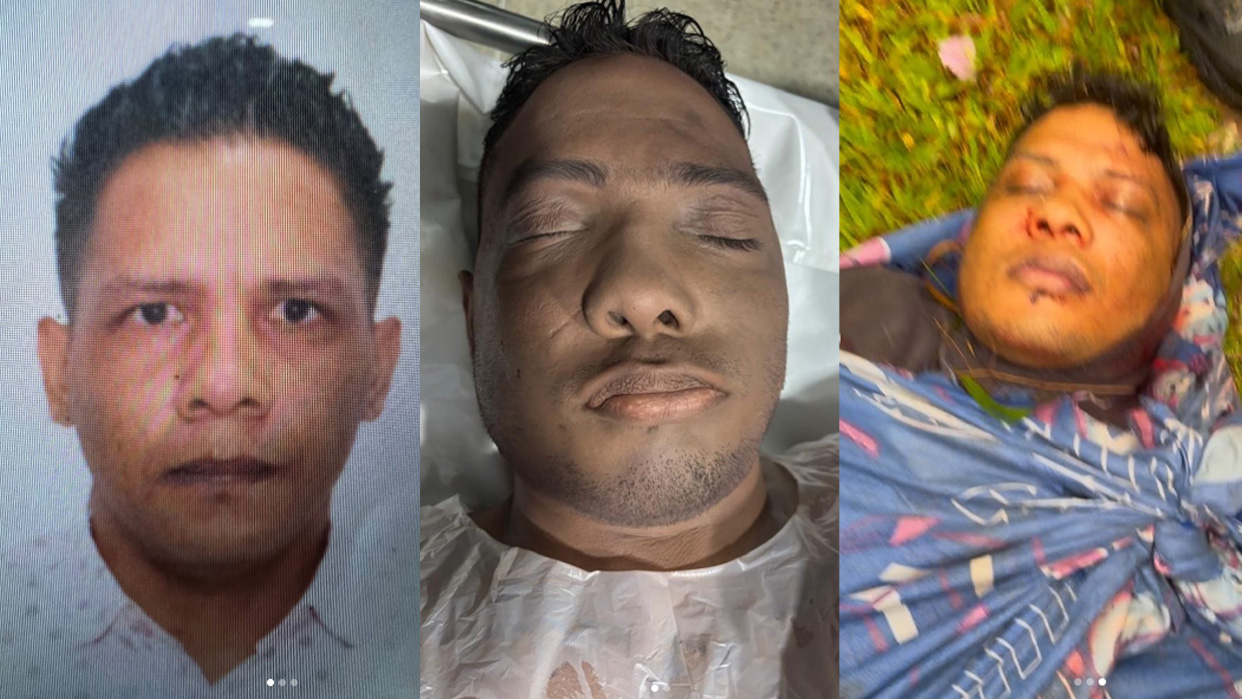 Con la muerte de alias “Wilexis”, las autoridades terminaron con la carrera de uno de los delincuentes más buscados del país (Fotos publicadas por el Cicpc)