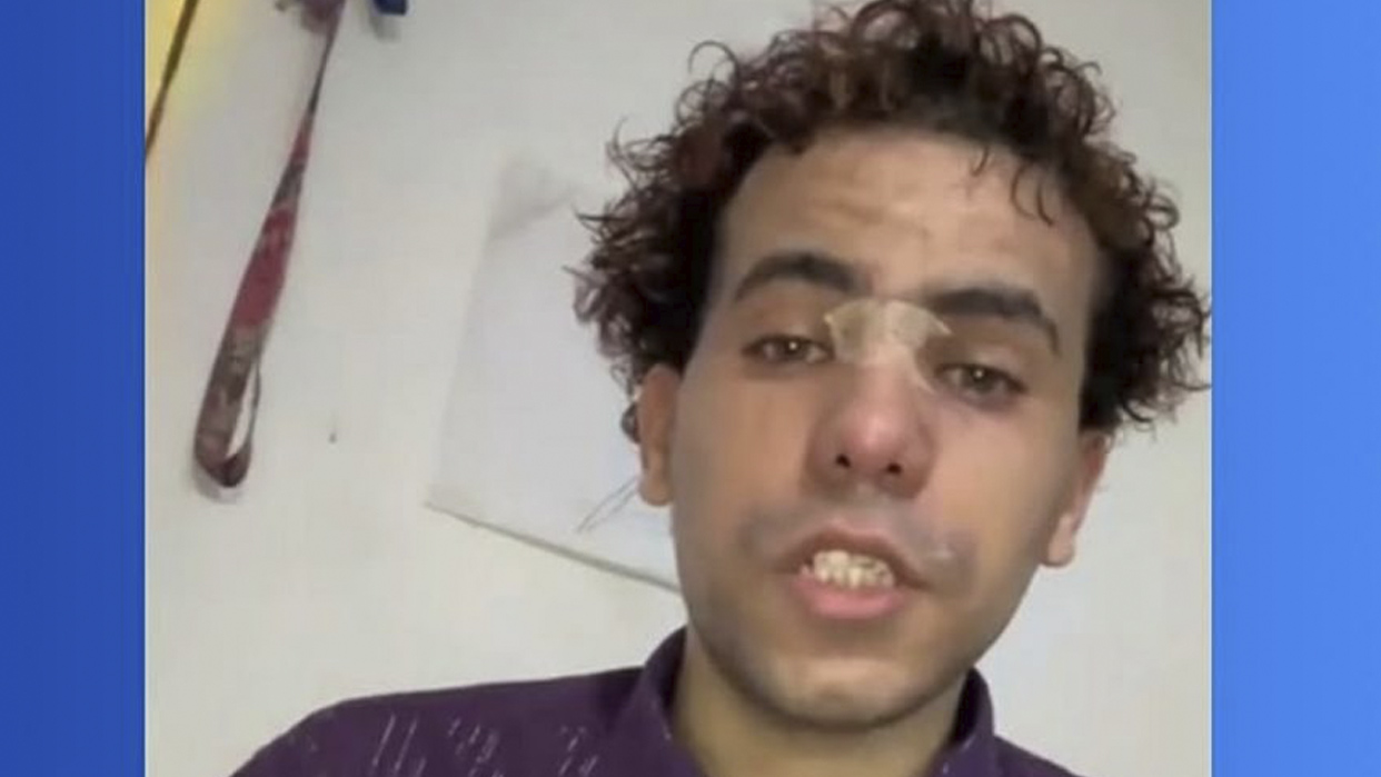 Carlos Benjamín Yánez Salcedo, joven con autismo, fue agredido la semana pasada (Foto publicada por el Ministerio Público)