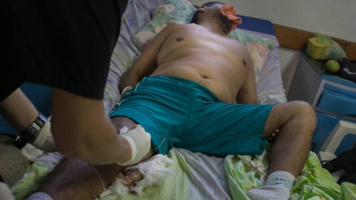 Los accidentes en moto llevan a las familias a gastar enormes cantidades de dinero para intentar recuperar la salud de los lesionados (Imagen cortesía)